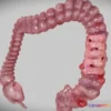 1522882 - PBR Game 3D Models - Diverticulosis And Diverticulitis 3D Max