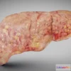 1522958 - PBR Game 3D Models - Fatty Liver 3D Max