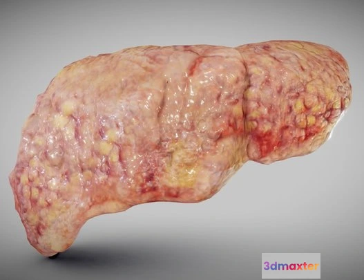 1522958 - PBR Game 3D Models - Fatty Liver 3D Max