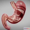 1528418 - PBR Game 3D Models - Stomach Cancer 3D Max